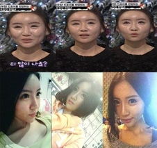  韩国整形中毒女从假人又整回真人了10