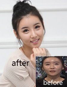  韩国整形中毒女从假人又整回真人