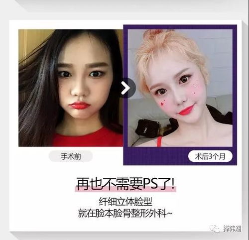  有图有真相,看看韩国男女整容真人案例